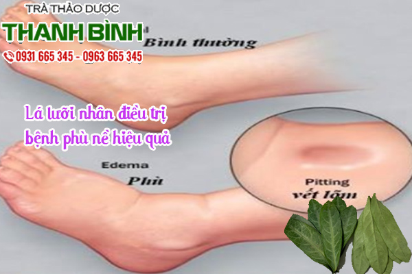 La luoi nhan 2