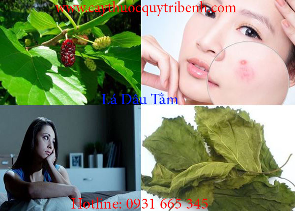 Mua-la-dau-o-dau-tai-tp-hcm-uy-tin-nhat