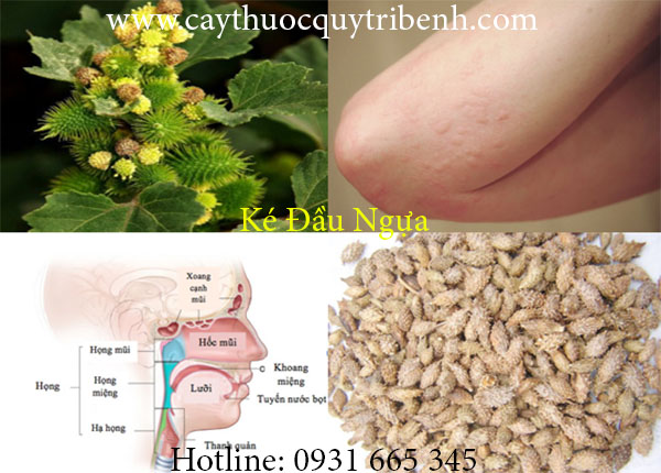 Mua-ban-ke-dau-ngua-tai-tp-hcm-uy-tin-nhat