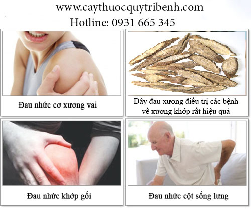 dây đau xương