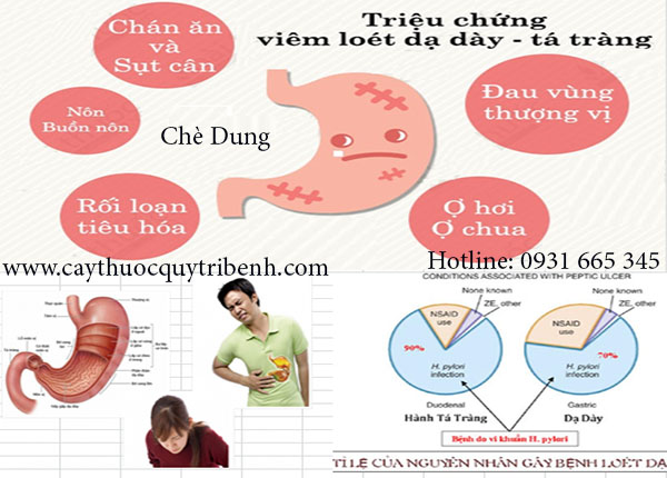 chè dung