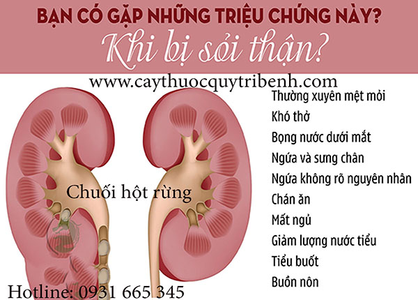 chuối hột rừng