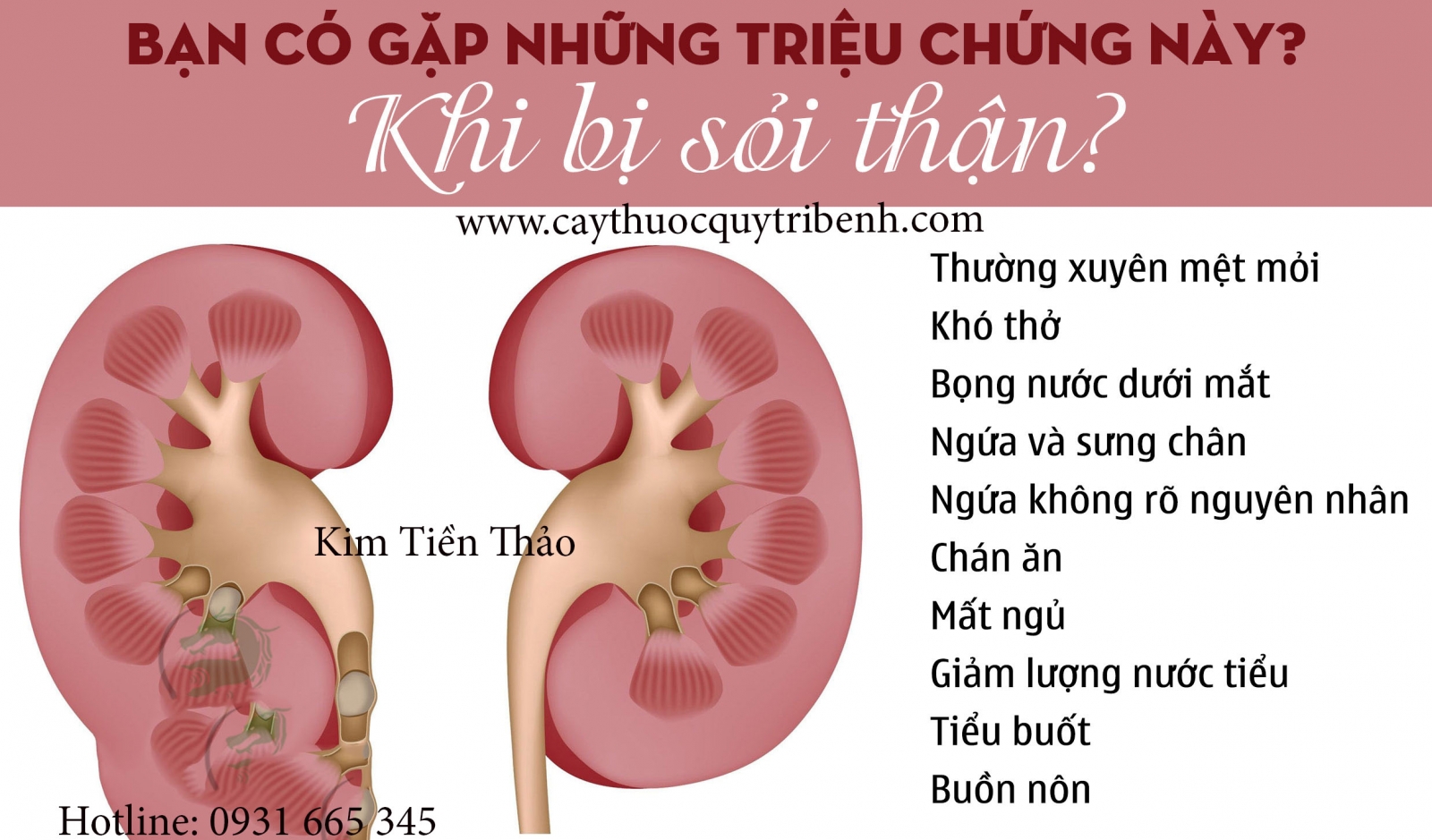 kim tiền thảo