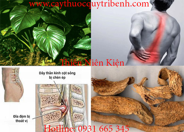 cây thiên niên kiện