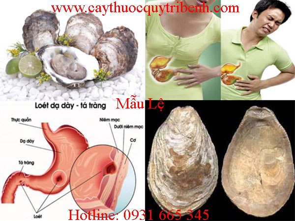 mua-mau-le-o-dau-tai-tp-hcm-uy-tin-nhat