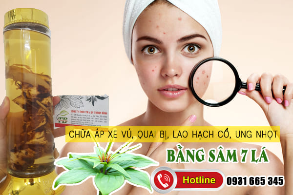 sâm 7 lá thảo dược thanh bình