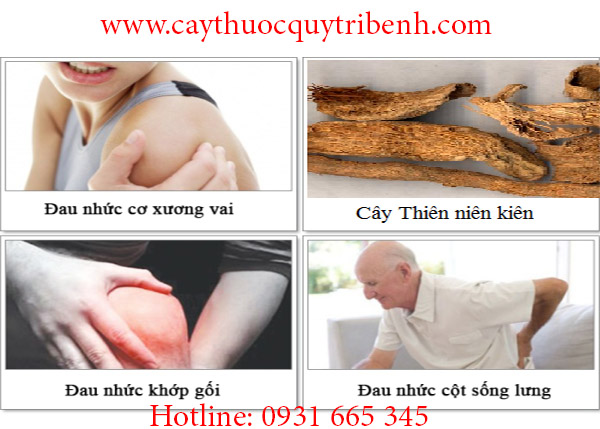 thiên niên kiện