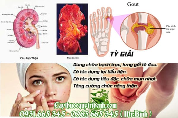 tỳ giải