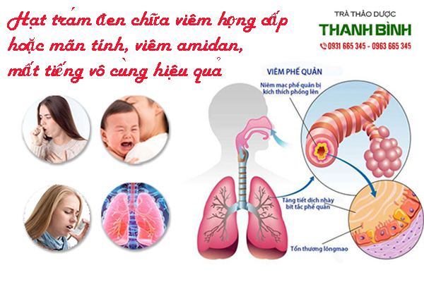 hat-tram-den-thanh-binh-1