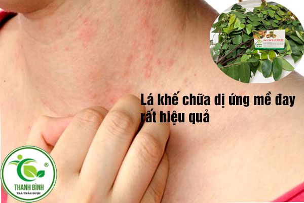 la-khe-thao-duoc-thanh-binh