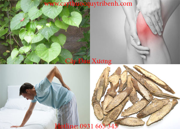 dây đau xương