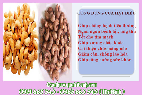 Hạt điều