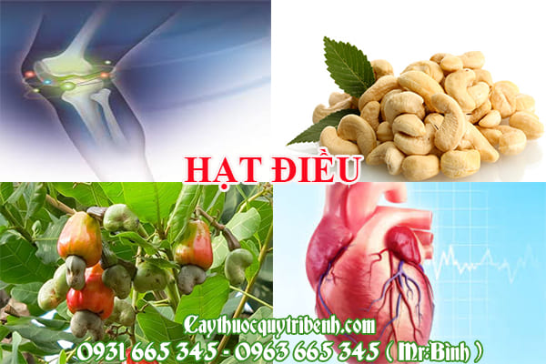 Hạt điều