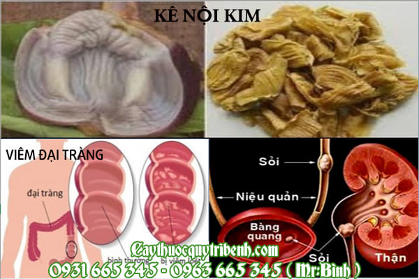 kê nội kim