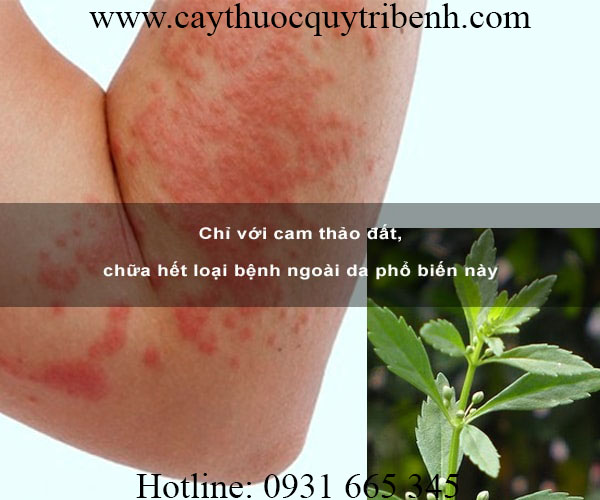 cam thảo đất