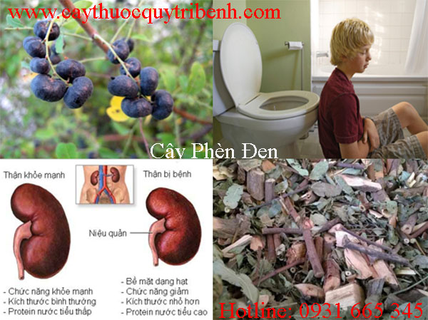mua-cay-phen-den-o-dau-tai-tp-hcm
