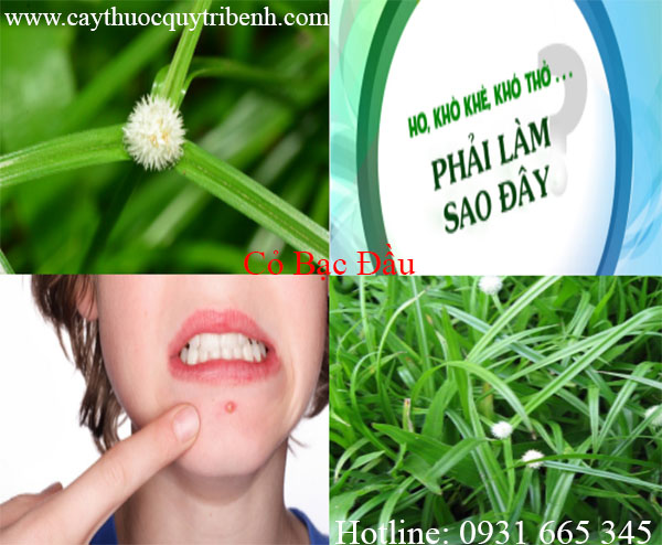 mua-co-bac-dau-chat-luong-tai-tp-hcm