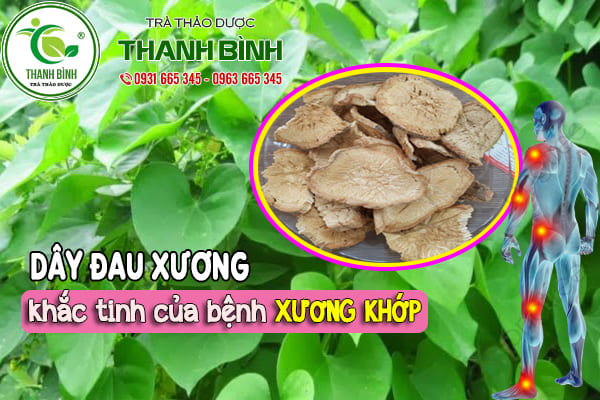 dây đau xương thanh bình
