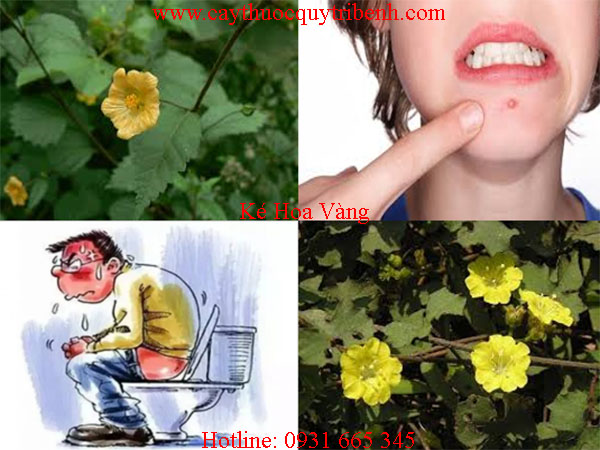 mua-ke-hoa-vang-o-dau-tai-tp-hcm-uy-tin