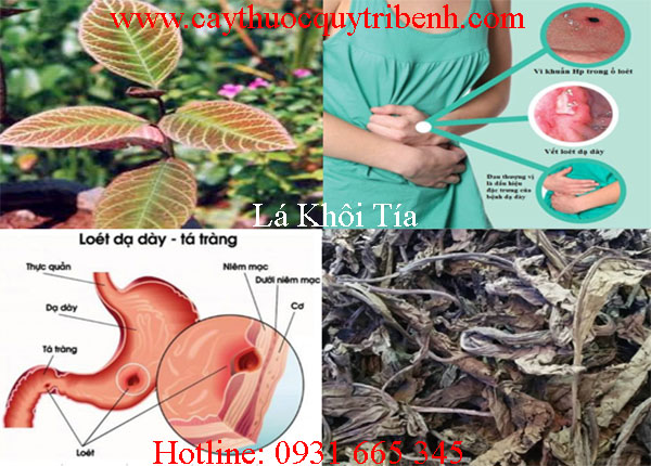 mua-la-khoi-tia-o-dau-tai-tp-hcm-uy-tin