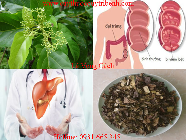 lá vọng cách