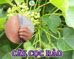 Mua bán cây cọc rào tại Lai Châu hỗ trợ cải thiện đau nhứt khớp hiệu quả