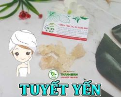 Mua bán tuyết yến tại Bắc Ninh giúp tốt cho người bị máu nhiễm mỡ