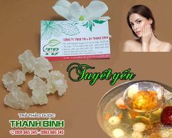 Mua bán tuyết yến tại huyện Từ Liêm ngăn ngừa các bệnh về cơ