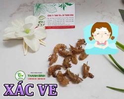 Mua bán xác ve tại Bình Thuận giúp giảm thiểu chứng đau đầu