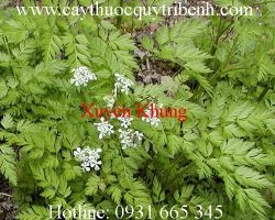Mua bán xuyên khung chất lượng tại Bình Dương giúp điều trị đau đầu